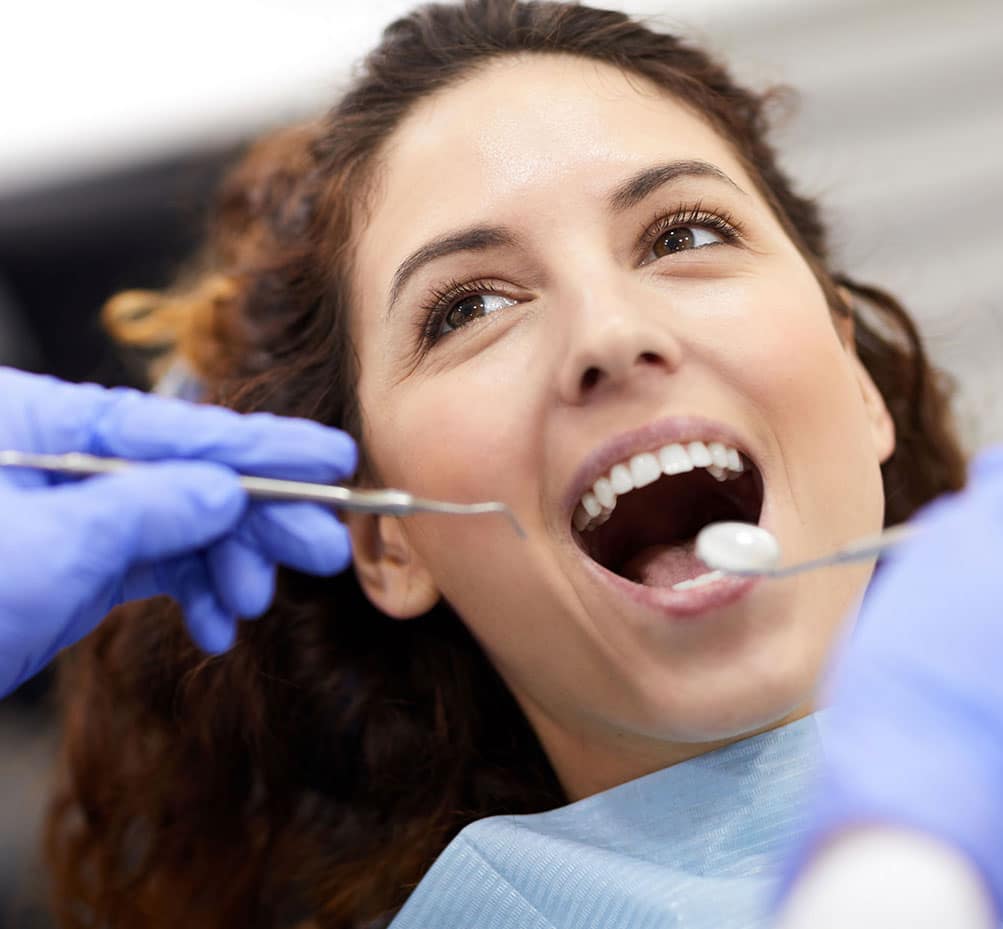 Smile Makeover